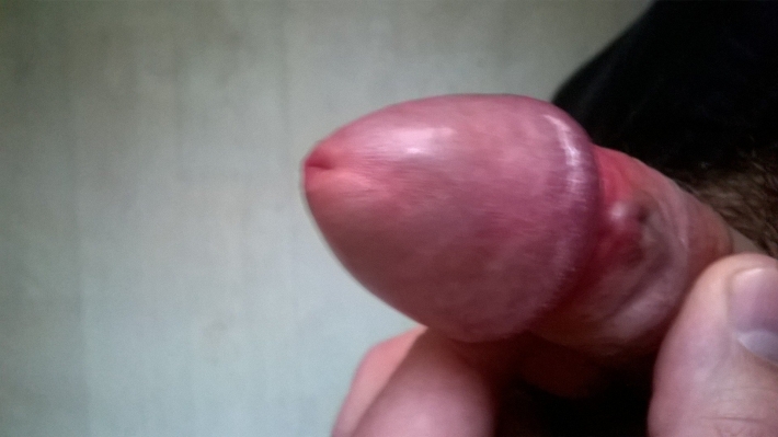 Красные пятнышки на головке члена