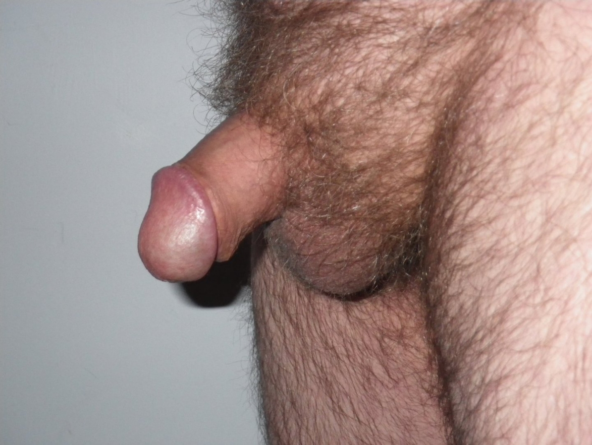 Маленькие мужские члены