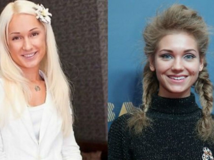 Ольга бузова до и после пластики